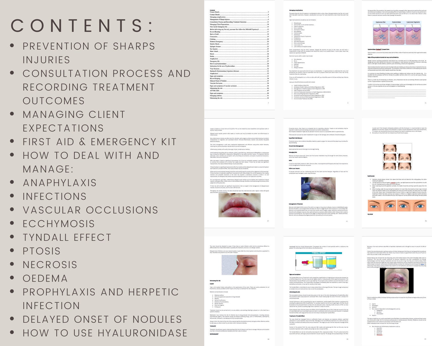 Managing Complications Editable Training Manual